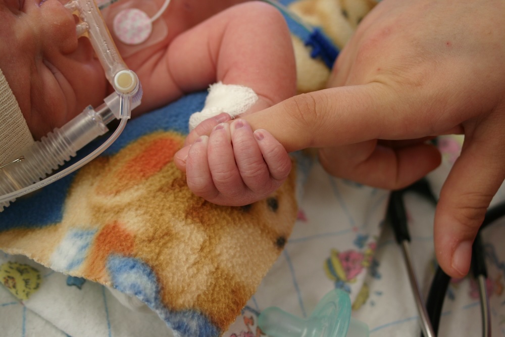 A hospitalized infant with a breathing apparatus on its face holds onto the finger of an adult