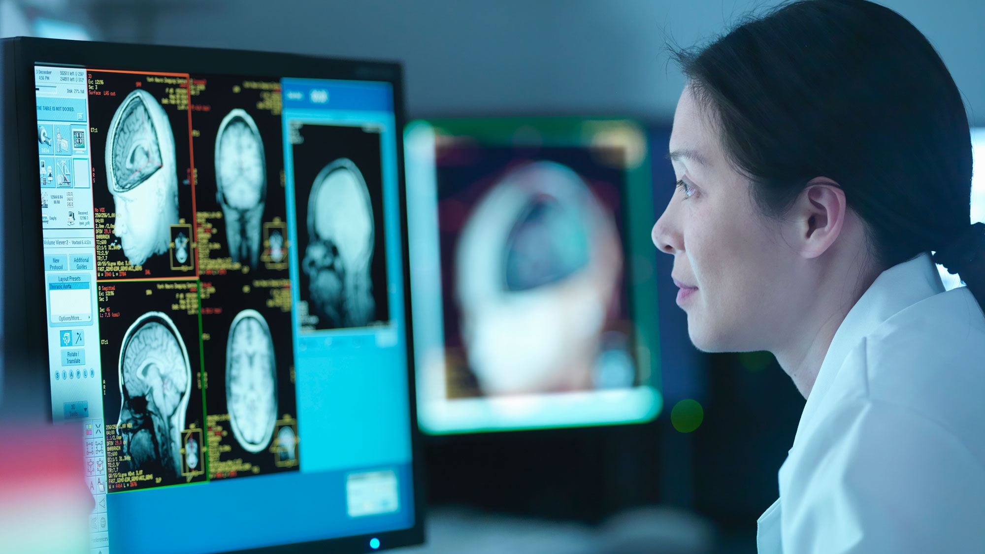 Medical research examines brain images on a computer