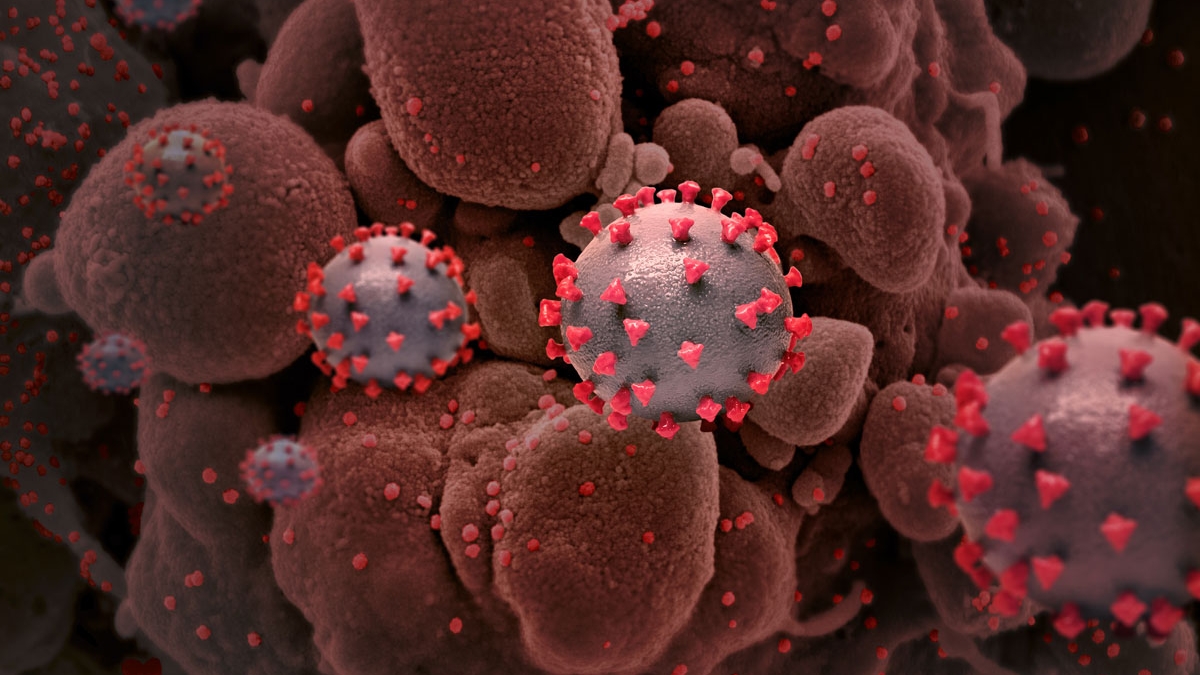 An illustration of the virus COVID-19 courtesy of National Institute of Allergy and Infectious Diseases