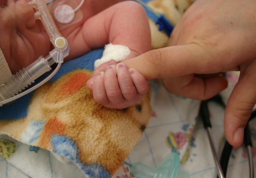 A hospitalized infant with a breathing apparatus on its face holds onto the finger of an adult